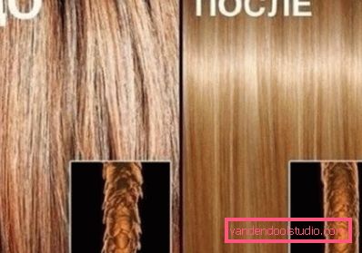 волоски до і після процедури