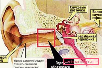 формування пробки формування пробки