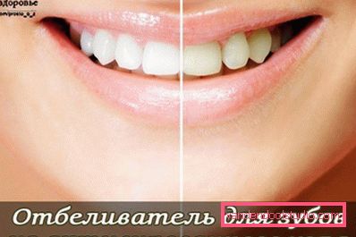 ефект від процедури ефект від процедури