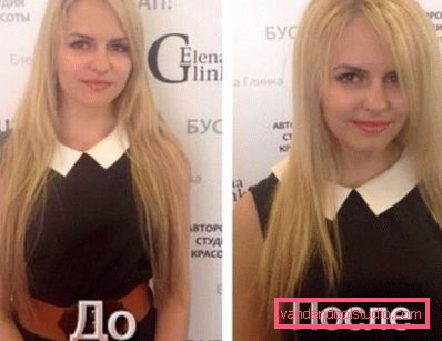 Прикореневій обсяг волосся Буст ап (Boost UP) - все про процедуру