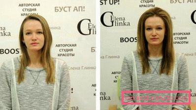Прикореневій обсяг волосся Буст ап (Boost UP) - все про процедуру