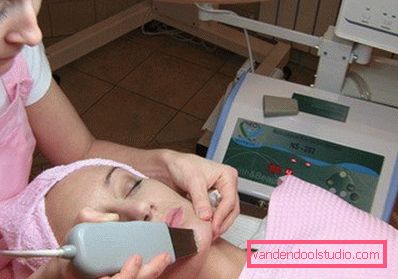 ультразвукова епіляція на обличчі ультразвукова епіляція на обличчі