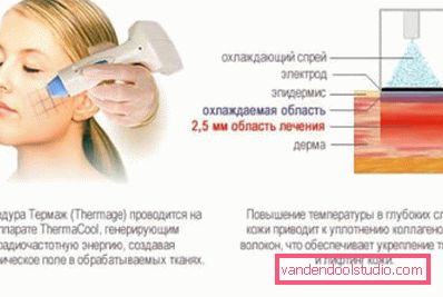 термаж термаж