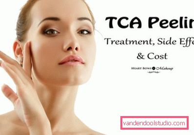 TCA Peeling TCA Peeling