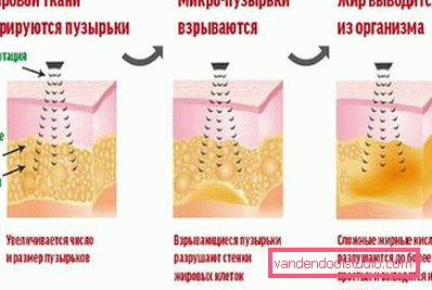 схема дії схема дії