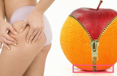 целюліт на ногах целюліт на ногах